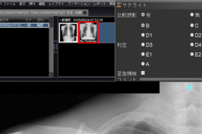 xray